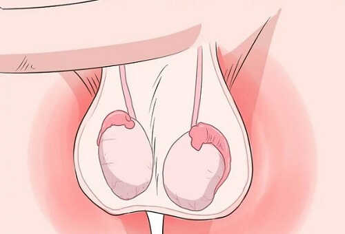 Tinh hoàn có cục cứng 